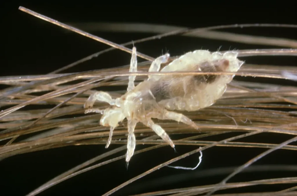 Prévenir les Infestations de Poux par Contact Direct - Centre Anti Poux